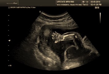 Obituary of Hope Elizabeth MacDonald