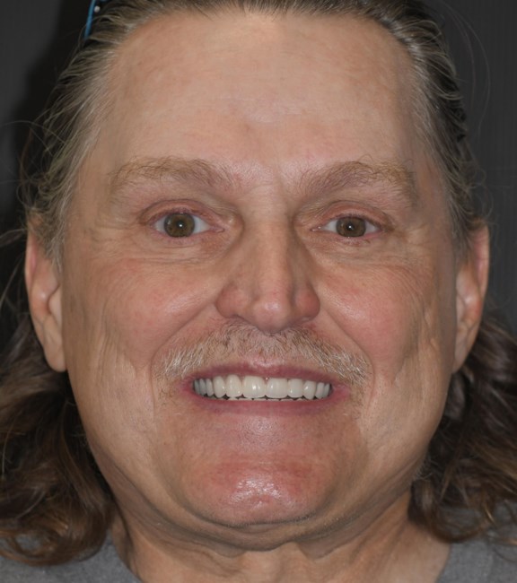 Obituary of Rex Gordon Masters