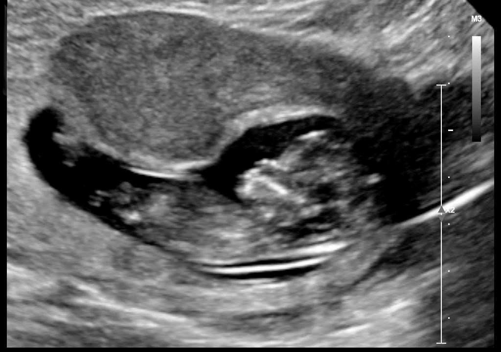 Obituary of Luna Casillas