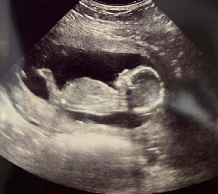 Obituary of Lyla Marie Pahl